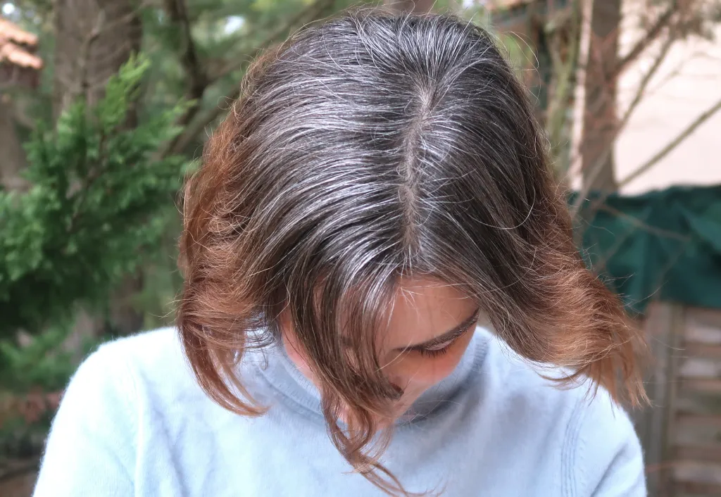 Comprendre les causes de la chute de cheveux chez la femme